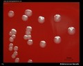 enterococcus faecalis